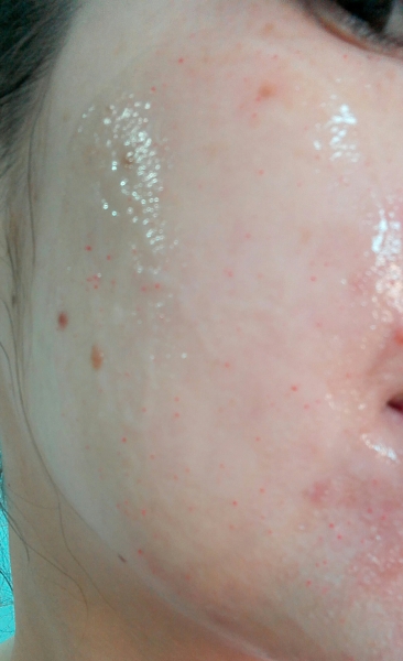 L'Oreal Skin Perfection Radiance Revealing Gentle Face Exfoliater L'Oreal Skin Perfection Radiance Revealing Gentle Face Exfoliater