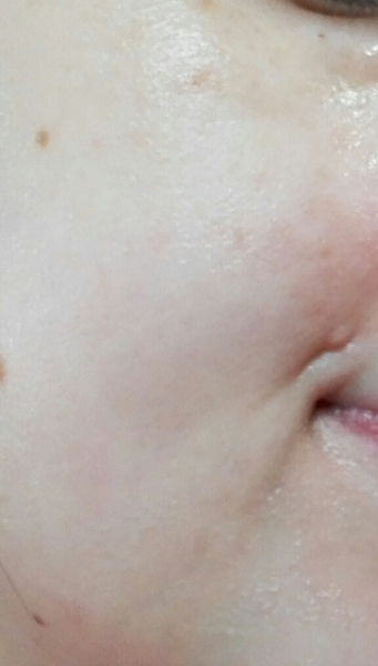 Dermacol Acne Clear Antibacterial Face Wash Gel Dermacol Acne Clear Antibacterial Face Wash Gel